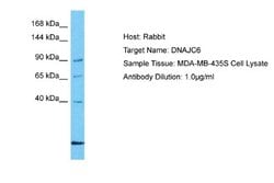 DNAJC6 Antibody, Novus Biologicals 100 &mu;L | Buy Online | Novus Biologicals | Fisher Scientific
